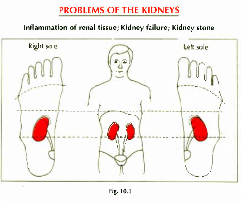 10.1 kidney failure stone renal tissue img