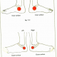 11.2 & 3 menstrual disorders leucorrhoea img