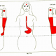 11.4 morning sickness img