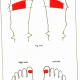 11.8 & 9 pain lump deficiency of milk img