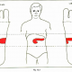 12.3 pancreas diabetes mellitus img