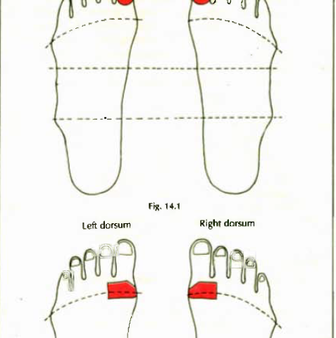 14.1 & 2 obesity img