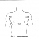 31 front of shoulder