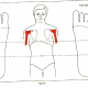 6.7 frozen shoulder stiffness pain img