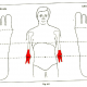 6.8 elbow problem img