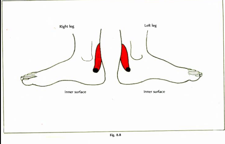 8.8 anus piles anal fissure fistula img