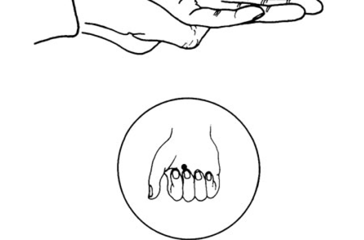3.7 massaging the pericardium