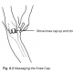 6.2 massaging the knee cap