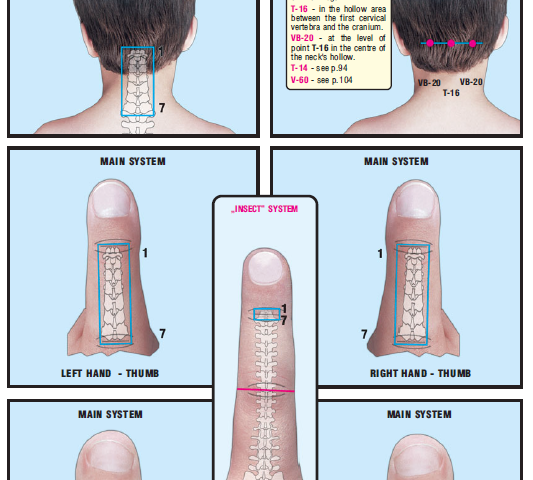 Spine & cervical vertebrae 44