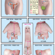 right ovary and uterine tube 37